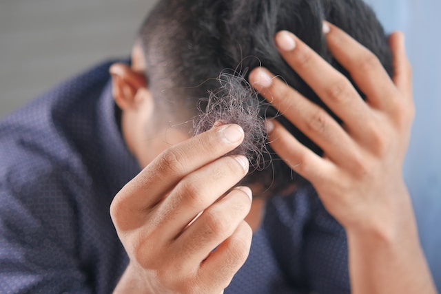 Understanding COVID Hair Loss Treatment: Causes, Solutions, And Recommendations